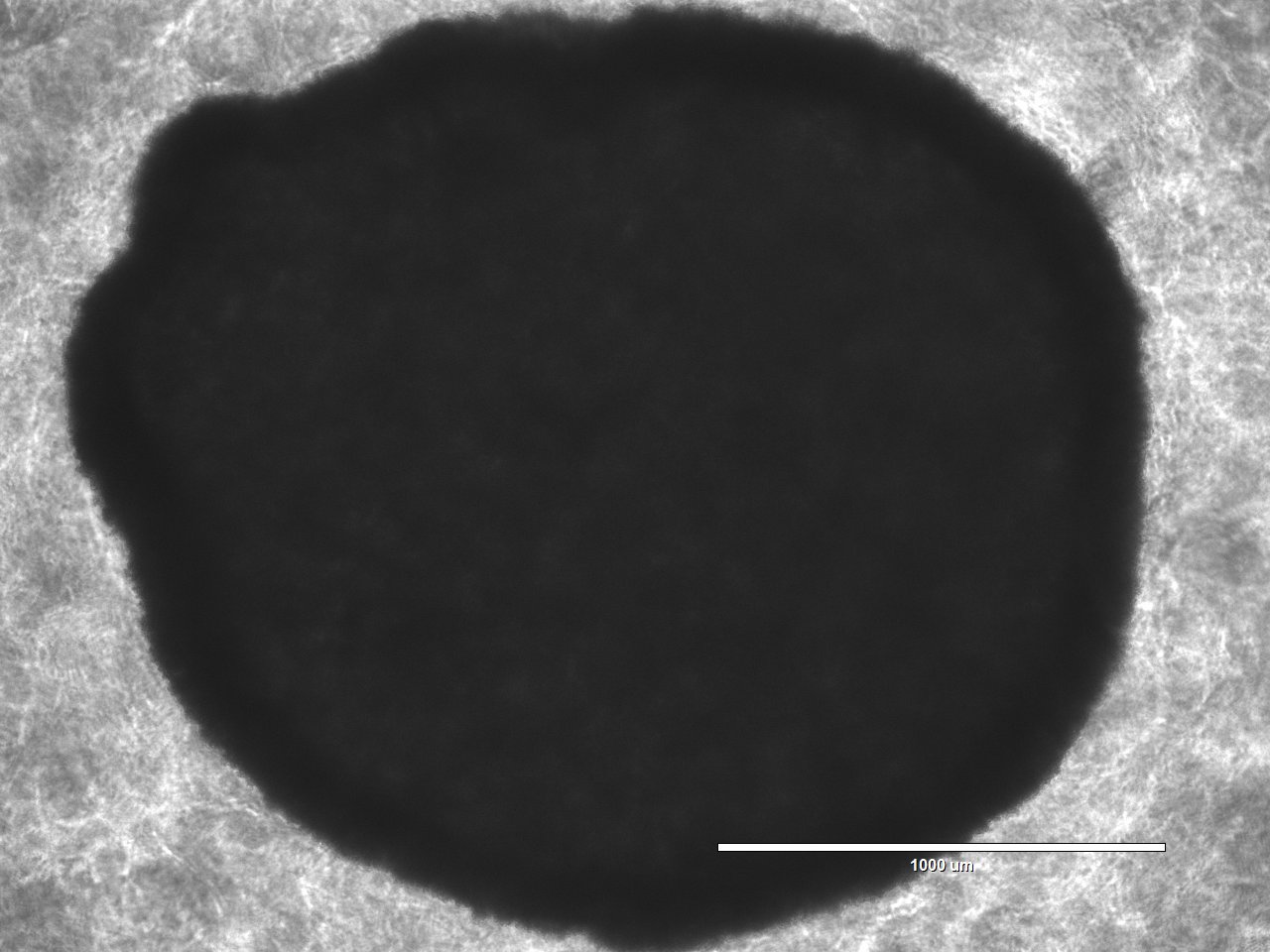 Brightfield microscope image of a 3D tumoroid grown at DEAR Lab (scale bar 1000 µm)