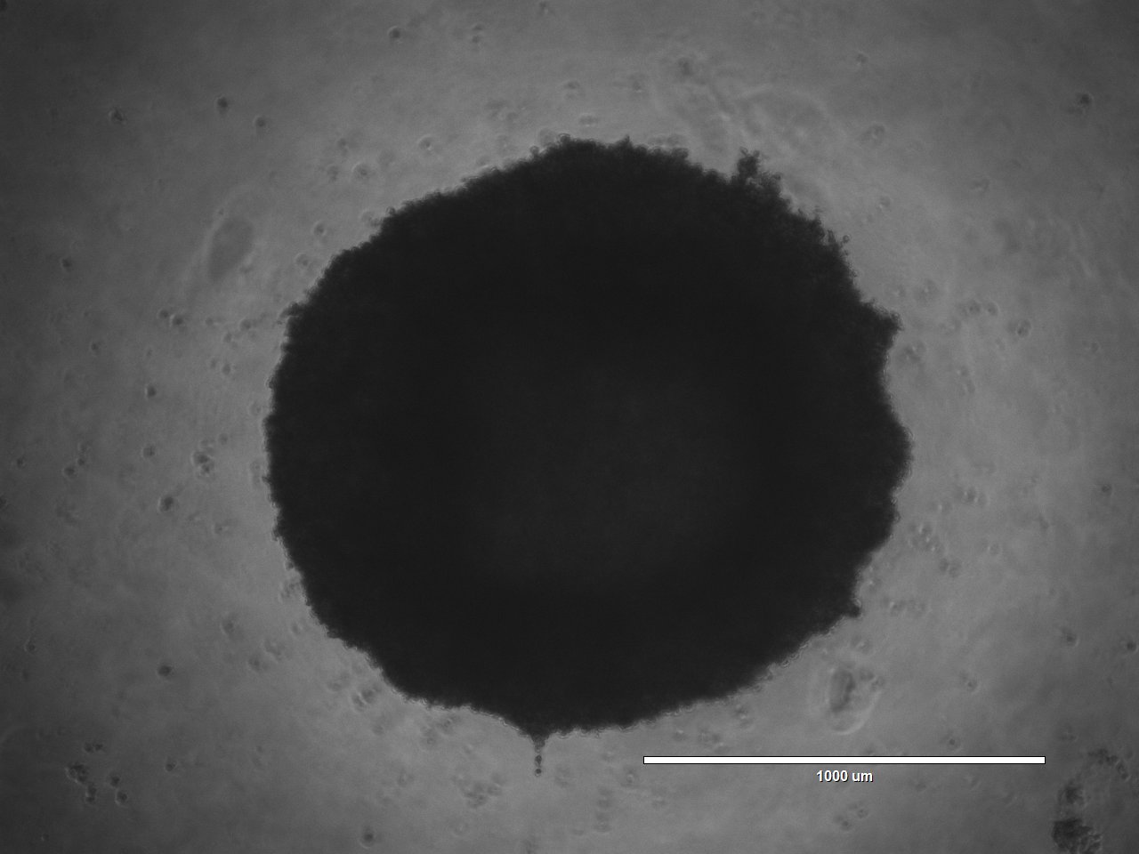 Brightfield microscope image of a 3D tumoroid grown at DEAR Lab (scale bar 1000 µm)