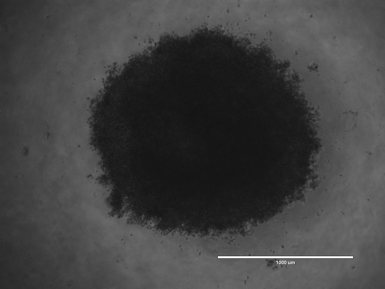 Brightfield microscope image of a 3D tumoroid grown at DEAR Lab (scale bar 1000 µm)