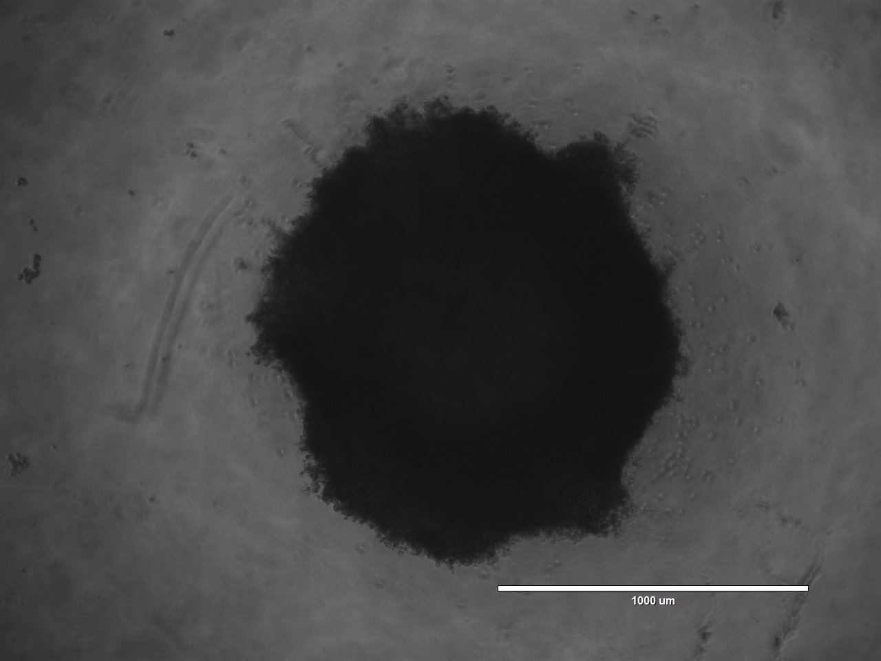 Brightfield microscope image of a 3D tumoroid grown at DEAR Lab (scale bar 1000 µm)